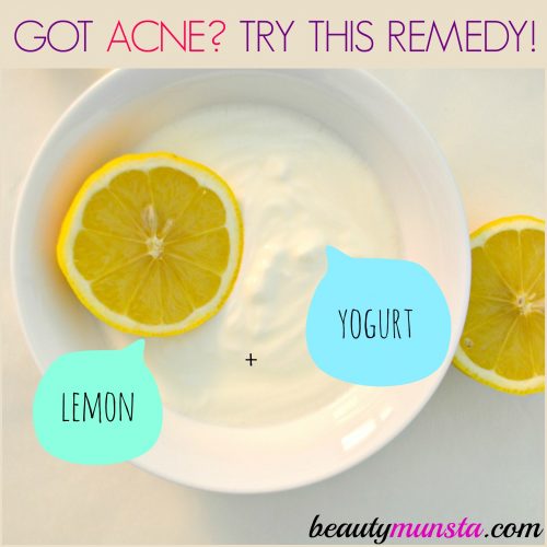 Yogurt and honey face mask for acne