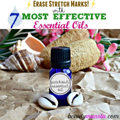 I got stretch marks on my hips when I was in high school. The worst part was they were purple! X( Essential oils to the rescue! Here are the most effective essentials oils to help fade stretch marks fast! 