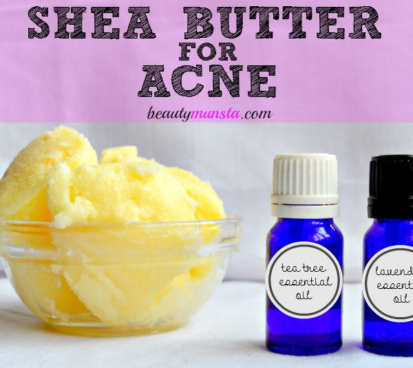 "Does Shea Butter Help with Acne? – How effective is it?" Find out how effective shea butter is for acne! 