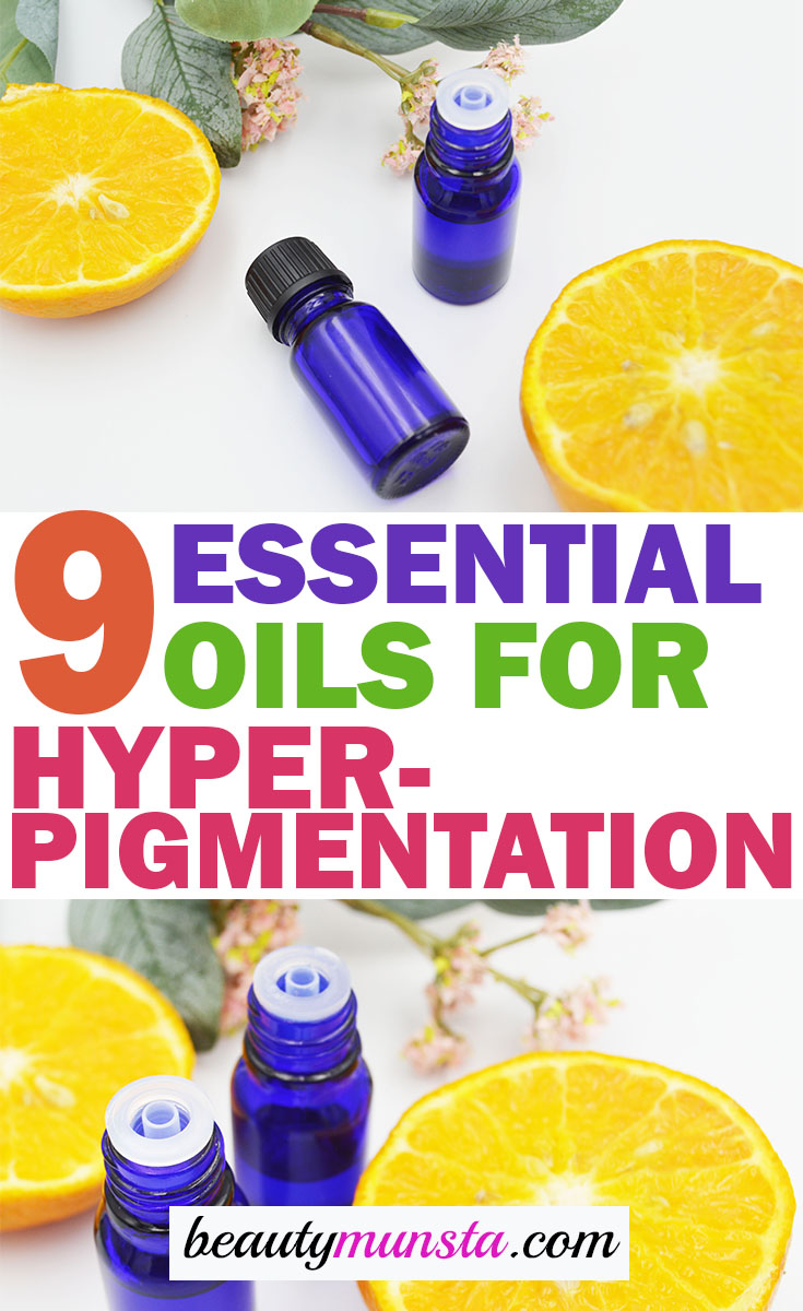 essential oils for hyperpigmentation