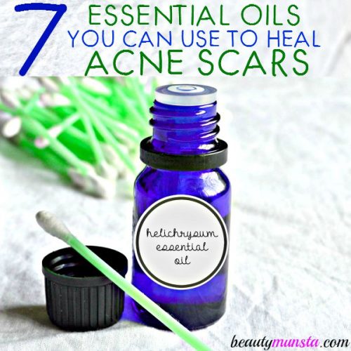 As I type this, I have some acne scars on my cheeks and I’m trying to heal and fade them faster using natural remedies. And one of the best natural remedies you can use is essential oils for acne scars! With the 7 essential oils for acne scars I’ve listed below, you can heal your acne scars in no time.