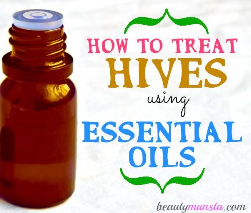 Here are 5 of the best essential oils to treat hives plus effective recipes that really work in soothing & calming those itchy hives! 