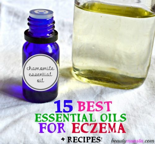 Here's how you can treat eczema with 15 of the best essential oils. Recipes included! 