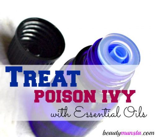 Soothe and calm poison ivy rashes and itchiness using essential oils! 7 best essential oils to treat poison ivy...