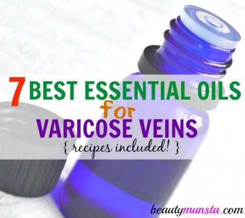 The best essential oils for varicose veins and homemade treatment recipes! 