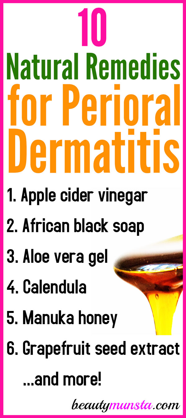 Perioral dermatitis treatment vinegar