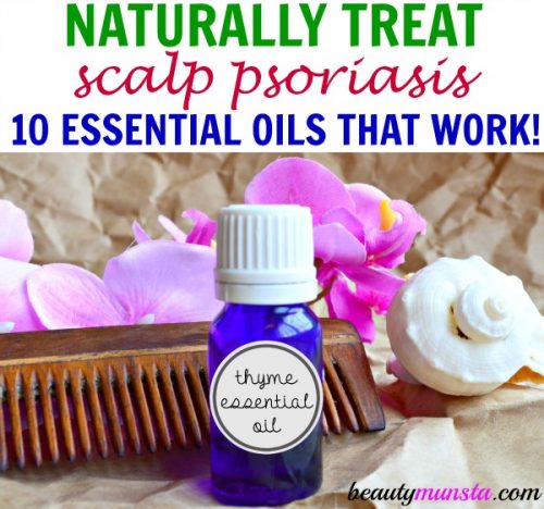 Naturally treat scalp psoriasis with essential oils! Discover 10 best essential oils for scalp psoriasis 