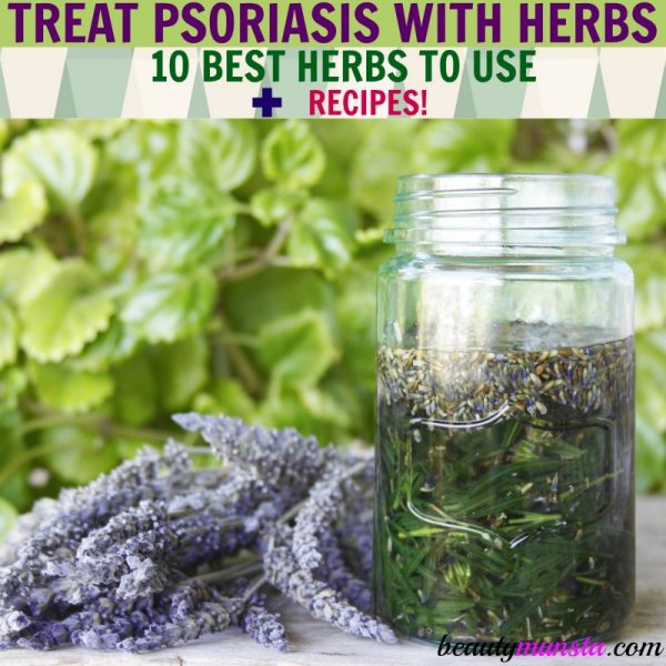 Learn how to treat psoriasis with herbs in this post! 
