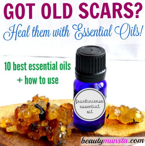 It is possible to heal and fade away old scars! How? Using essential oils of course!