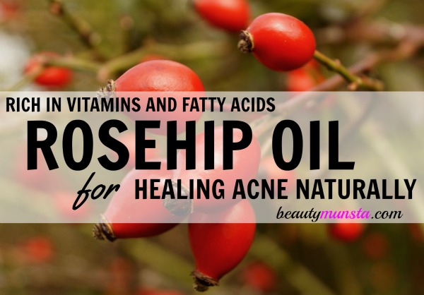 Is Rosehip Oil Good for Acne? - beautymunsta - free natural beauty ...