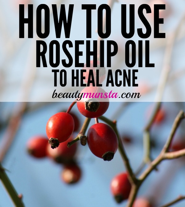 Find out how the benefits of rosehip oil for acne, its properties and 3 DIY recipes in this post! 