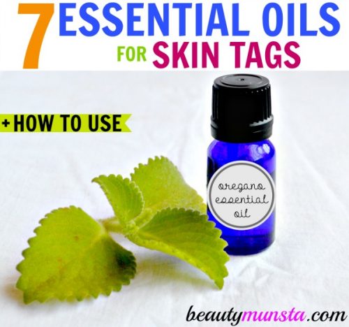 Essential oils for skin tags removal. Get rid of skin tags fast - the natural way! 