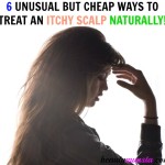 6 Unusual but Cheap Ways to Treat an Itchy Scalp Naturally