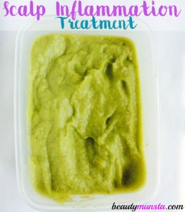 I used this DIY scalp inflammation treatment and it gave me instant relief by cooling and soothing my painful scalp!