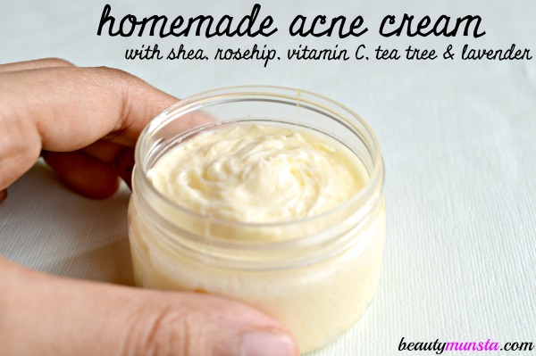 homemade cream for acne 