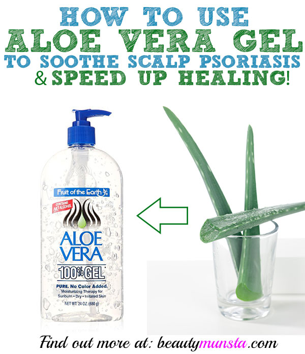 aloe vera on scalp psoriasis