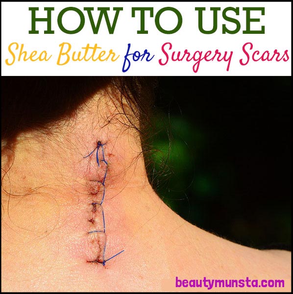 how to use shea butter for scars