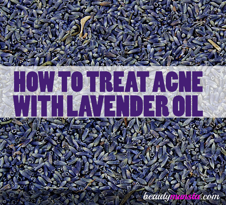 lavender oil on acne