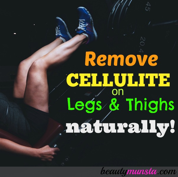 legs with cellulite