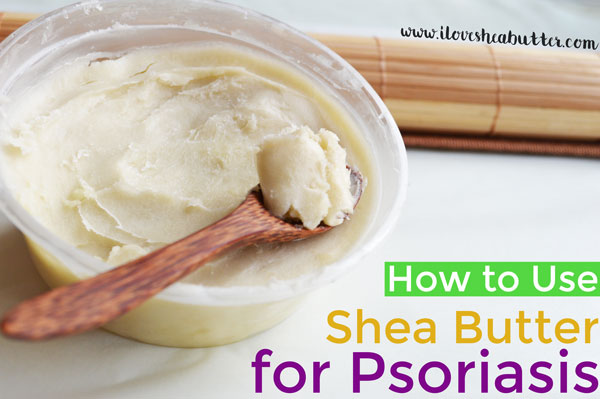 shea butter psoriasis