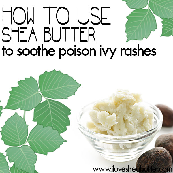 shea butter for poison ivy