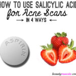 How to Use Salicylic Acid for Acne Scars
