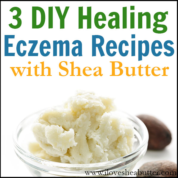 diy shea butter recipes for eczema