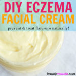 DIY Eczema Face Cream | Easy & Effective!