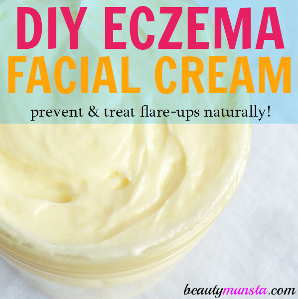 Make this easy DIY eczema face cream to prevent and treat flare-ups naturally!