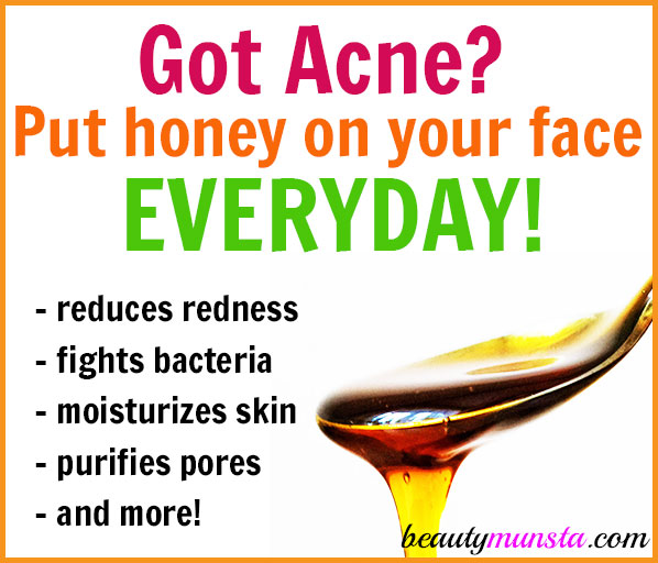 Learn how to use manuka honey for acne on your face everyday!