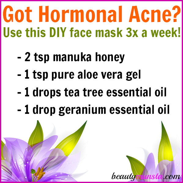 Make this DIY face mask for hormonal acne! It is cleansing, soothing and balances out excess sebum! 