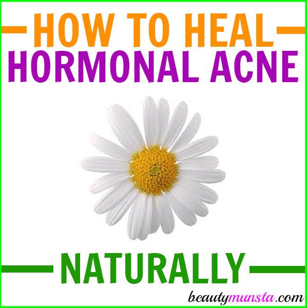 If you want to treat your hormonal acne naturally, follow this DIY hormonal acne protocol! It uses natural ingredients and simple holistic approaches to manage hormonal acne! 