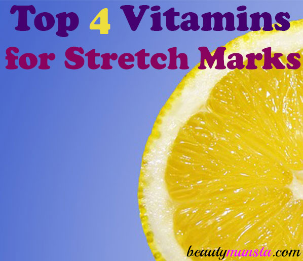 Stretch marks are an unavoidable part of many people’s life. Especially if you’re a woman, pregnancy stretch marks are bound to appear. But there are some remedies to help prevent them! Such as taking vitamins to prevent stretch marks! That’s what we shall be looking at in this article 