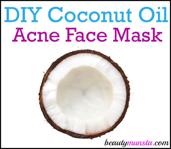 Find out how to make an easy and effective DIY coconut oil face mask for acne prone skin here! 