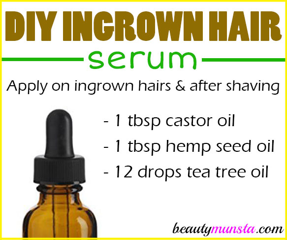 DIY Ingrown Hair Serum Recipe - beautymunsta