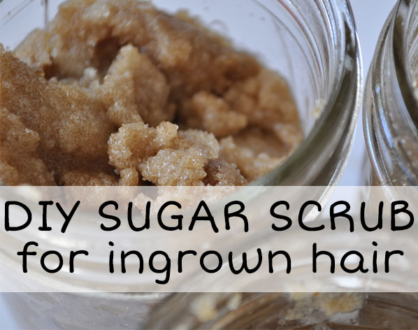 DIY Sugar Scrub for Ingrown Hair Prevention & Treatment ...