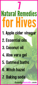7 Natural Remedies for Hives