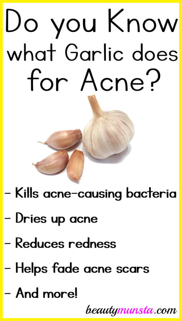 Garlic doesn’t just keep vampires away! Discover 6 amazing garlic benefits for acne to get clearer skin faster!