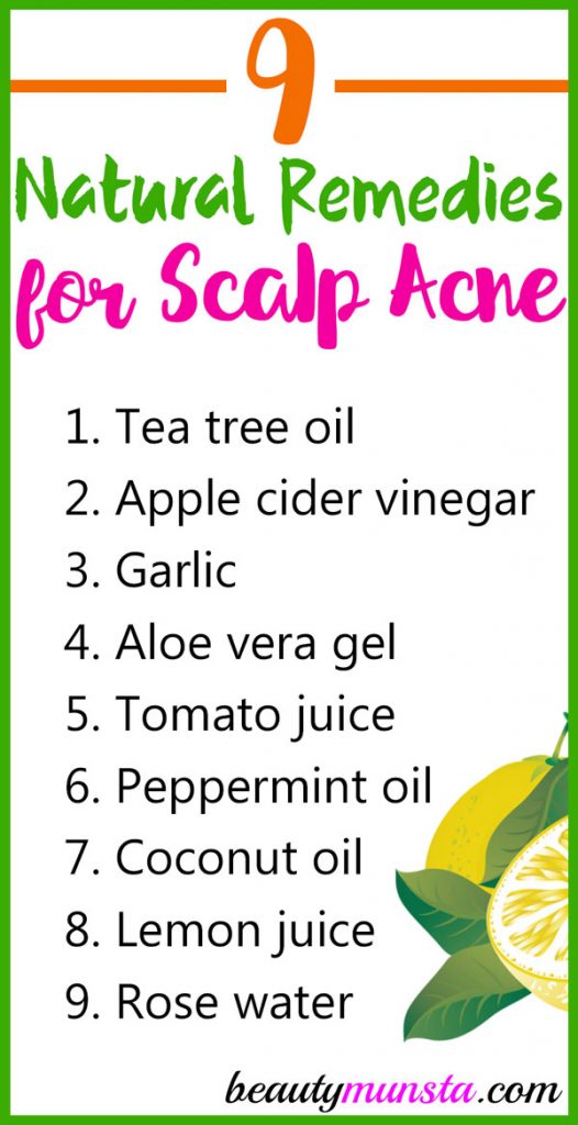 Scalp acne is horrible but the good thing is that it can be treated! Find out how to treat scalp acne naturally with natural remedies! 