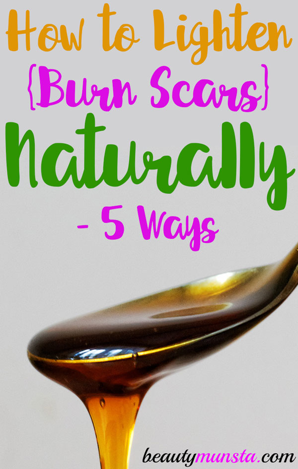 If you're wondering how to lighten burn scars naturally, you're in the right place! Here are 5 effective natural remedies that help!