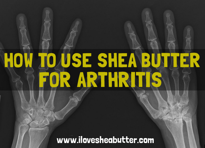 shea butter for arthritis