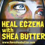 Homemade Shea Butter Lotion for Eczema