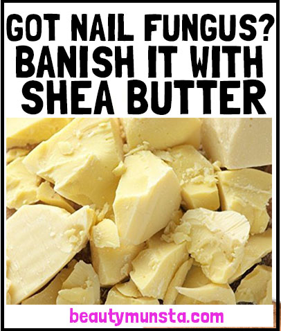 shea butter for nail fungus relief