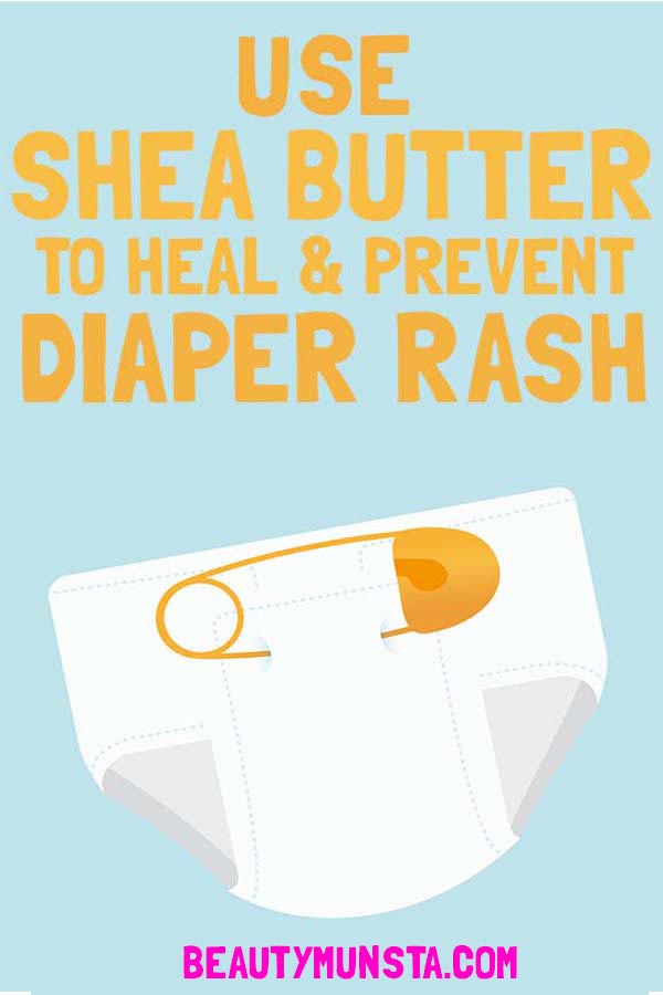 SHEA BUTTER FOR DIAPER RASH