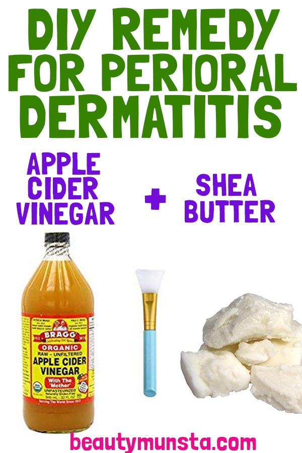 Dermatitis vinegar perioral treatment