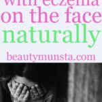 Top 10 Natural Remedies for Eczema on the Face