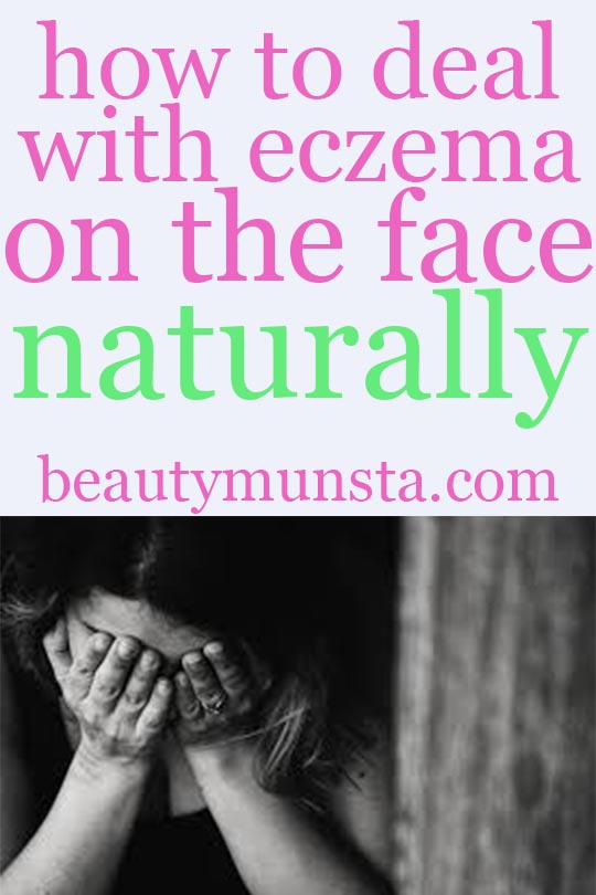 diy natural remedies for eczema on the face