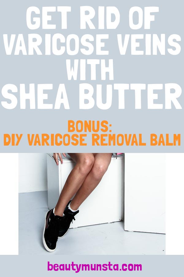 shea butter for varicose veins removal