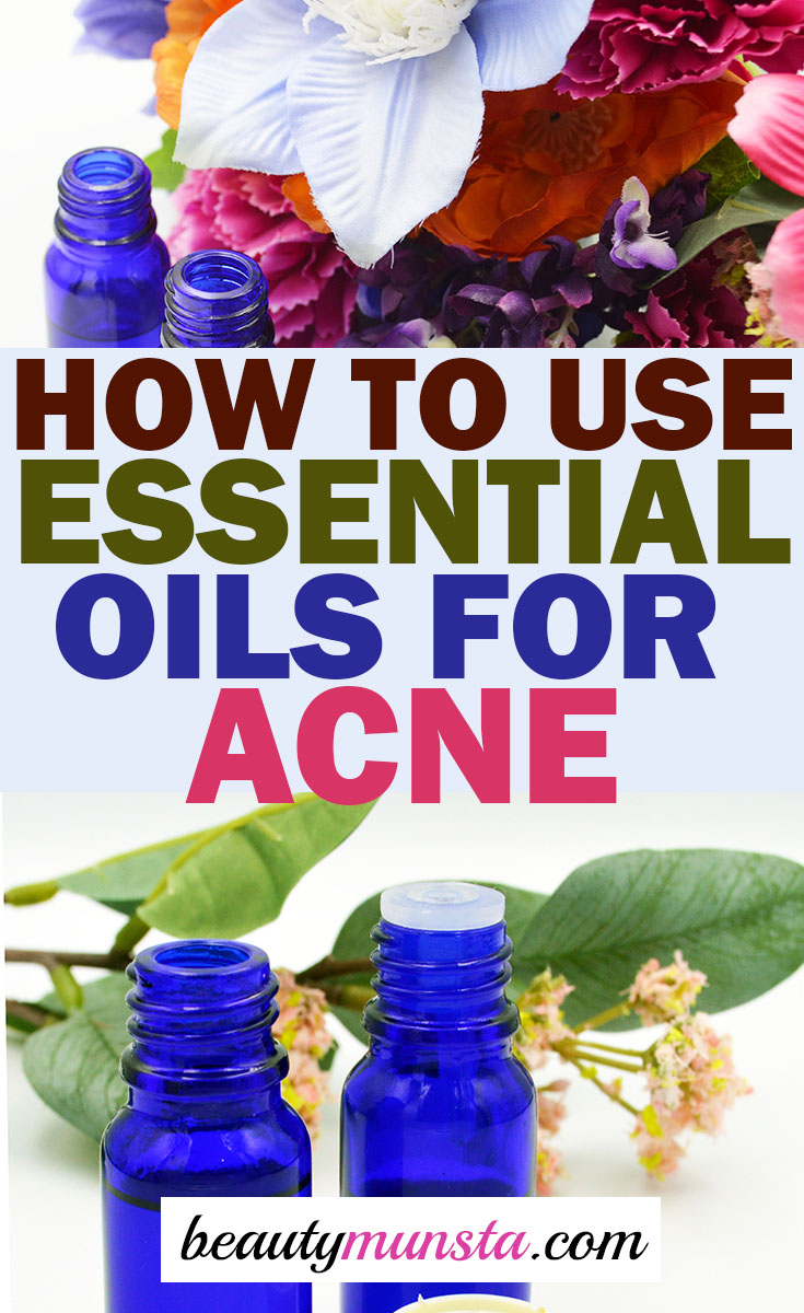 how to use essential oils for acne